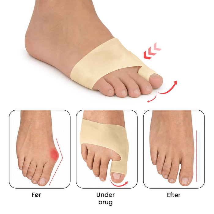 Gelstrømpe til hallux valgus