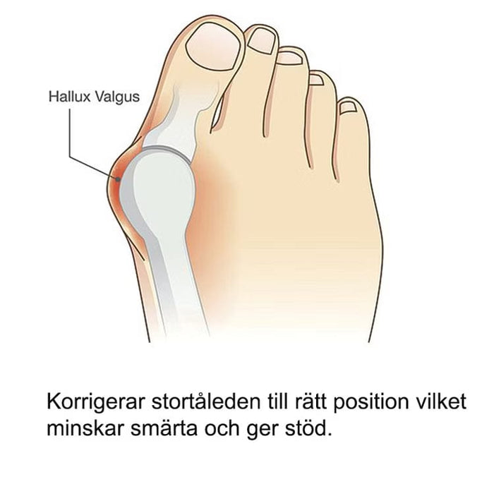 Kropsbutikken Hallux Valgus Hallux valgus silikonskydd