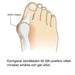 Kropsbutikken Hallux Valgus Hallux valgus silikonskydd