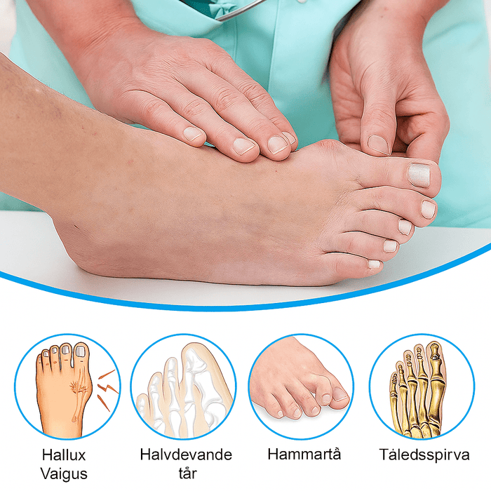 Kropsbutikken Hallux valgus Hallux Valgus - Storetå Separatører