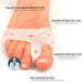 Kropsbutikken Hallux Valgus Mellemlæg Hallux valgus