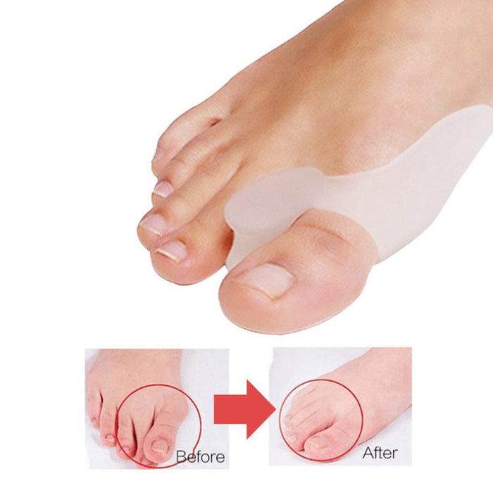Kropsbutikken Hallux Valgus Tåseparator (hallux valgus, 2-pak)